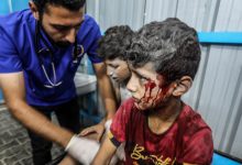 أكثر من 100 طفل يقتلوا أو يصابوا يوميا في غزة