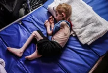 صور مأساوية من غزة.. أطفال وكبار يموتون جوعًا ويتحولون إلى هياكل عظمية